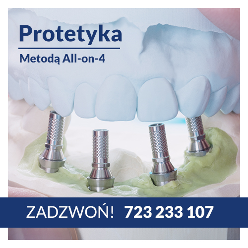 Metoda Leczenie All-In-4